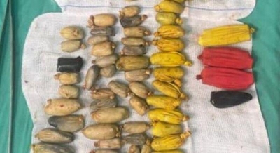 Homem engole 120 pacotes com drogas, simula assalto e sobrevive