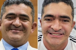 Mendes brinca com novo visual de Elizeu: “Botelho perdeu feio”