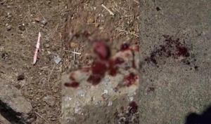 Homem corta a própria língua alegando ter bichos em sua cabeça
