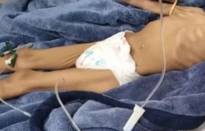 Sem comer há 40 dias, menina de 3 anos é resgatada e pai é preso